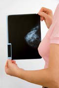 Mammographie - Au sein des femmes